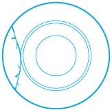 A crack arching across the outside of an end cap